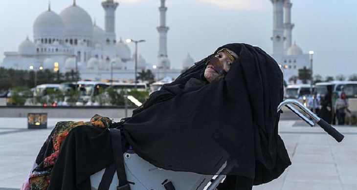 Женщина 27 лет находилась в коме. Очнулась и уехала в ОАЭ