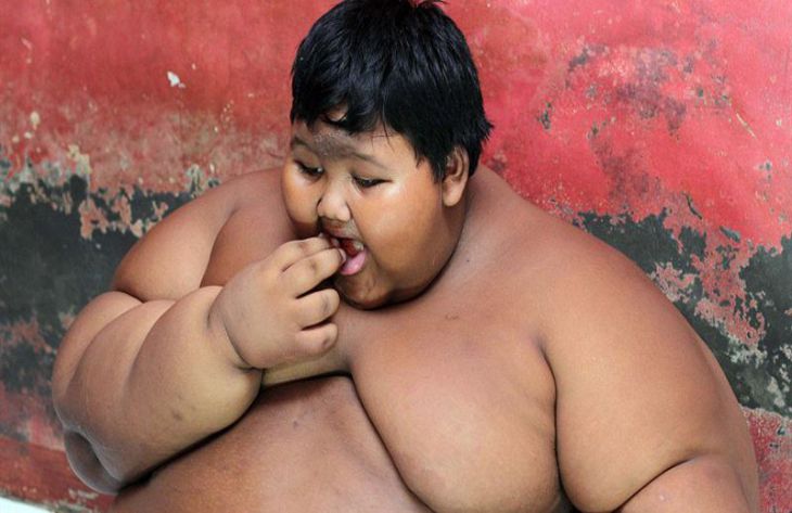 Родители самого толстого ребенка в мире не сразу заметили, что у сына проблемы с весом