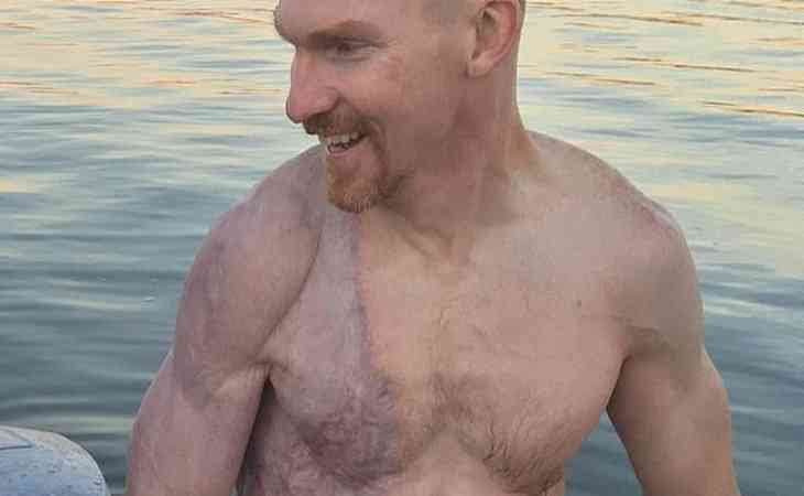 Плотоядные бактерии уничтожили часть тела мужчины Плотоядные бактерии уничтожили часть тела мужчины