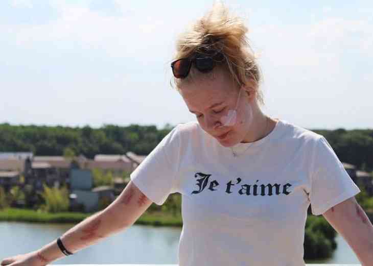 «Через 10 дней я умру». Изнасилованной девушке-подростку сделали эвтаназию