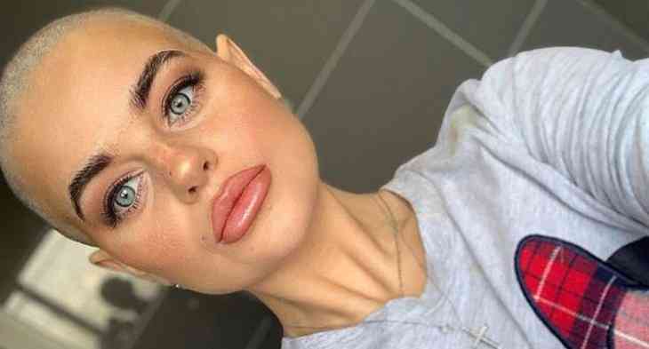 «Крем для тела спас мне жизнь». Девушка сама обнаружила у себя рак, который не нашли врачи