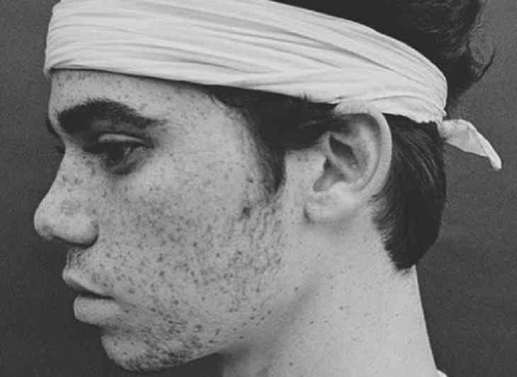 Названа причина смерти 20-летней звезды Disney