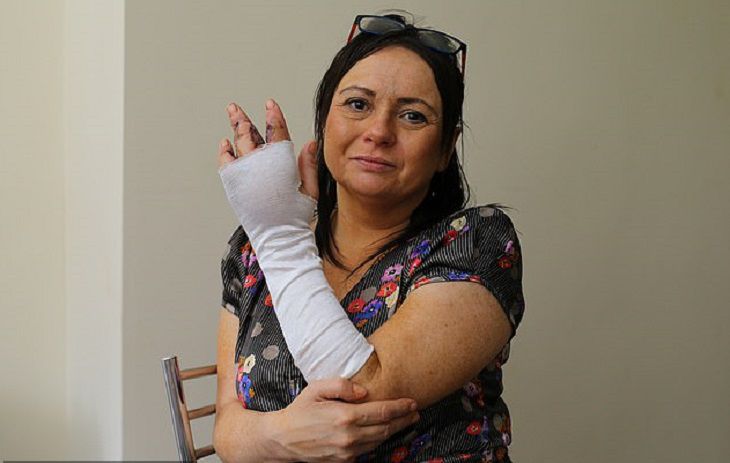 Котик оставил даму без пальца. Она еще легко отделалась 