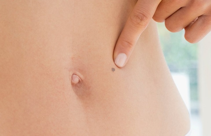 Стала известна причина быстрого развития рака кожи на первой стадии Стала известна причина быстрого развития рака кожи на первой стадии