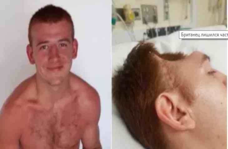 24-летний парень лишился части черепа после кошмарной поездки в магазин (18+)