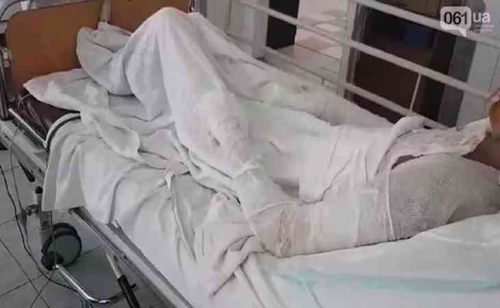 «Проснулась от ужасной боли». Муж залил матери своих детей в рот кипяток, пока она спала