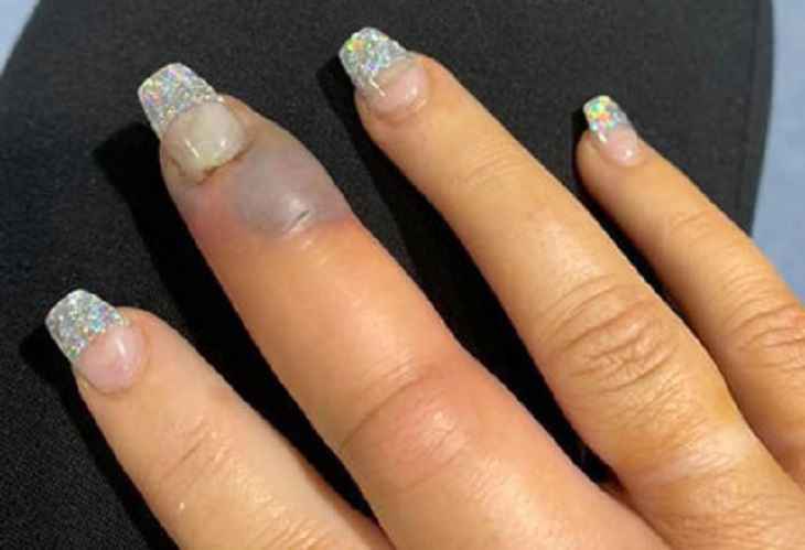 Женщина посетила салон красоты и подхватила опасную инфекцию Женщина посетила салон красоты и подхватила опасную инфекцию