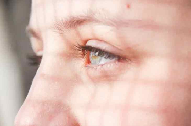 Около 50 тыс. лазерных вмешательств на глазах проводят ежегодно в Беларуси