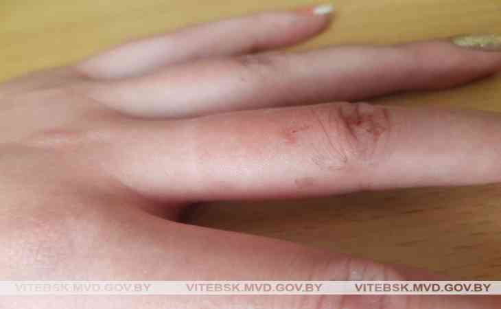 В Витебске за разбой задержали 25-летнюю девушку: угрожая ножом, отобрала у знакомой золотые украшения