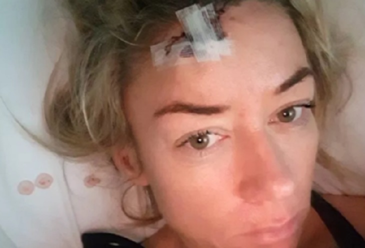 Любовь к загару довела девушку до смертельного заболевания Любовь к загару довела девушку до смертельного заболевания