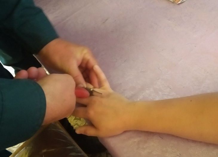 В Гомеле у девушки застрял палец. Пришлось откусить В Гомеле у девушки застрял палец. Пришлось откусить