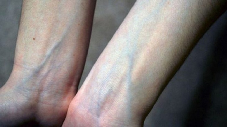 Создана технология распознавания людей по виду их вен на руках