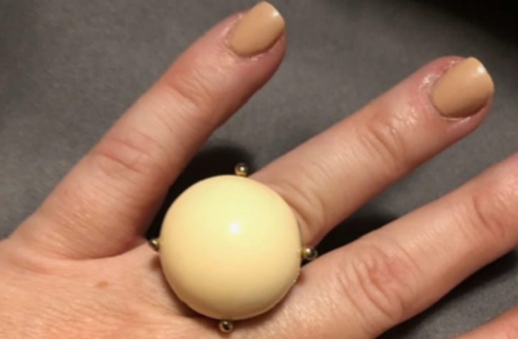 Похоже на большой прыщ. Девушку высмеяли за странное кольцо Похоже на большой прыщ. Девушку высмеяли за странное кольцо