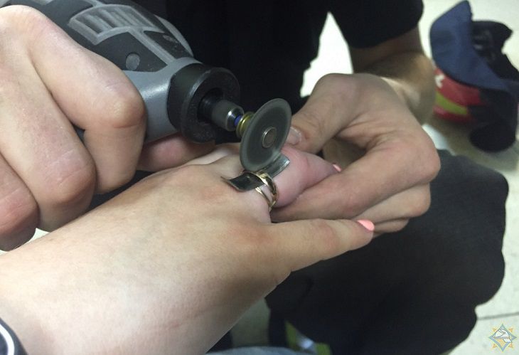 Не смогла снять кольца. В Минске спасатели пришли на помощь девушке