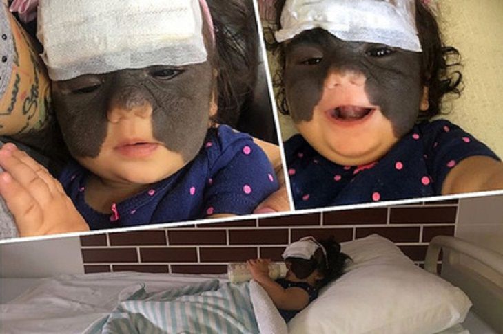 Мать «девочки-бэтмена» рассказала, как прошла первая операция