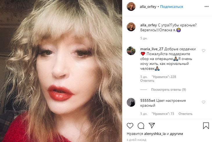 Раскрыт секрет резкого омоложения Пугачевой. Вот как это делают