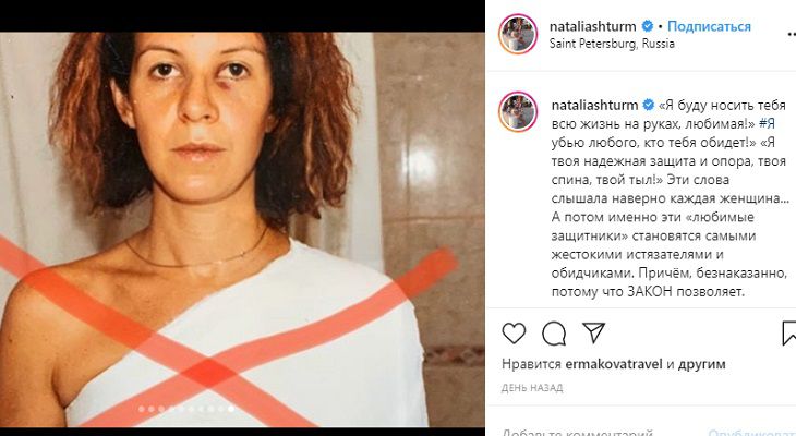 Наталья Штурм показала побои от бывшего мужа