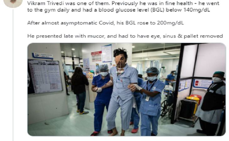 Страшные кадры из Индии: как черная плесень убивает выживших после коронавируса 