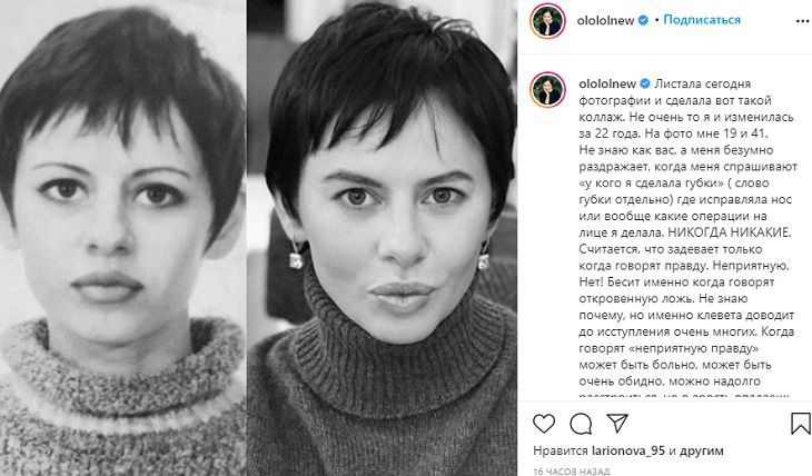 Оксана Лаврентьева показала себя до и после “пластики”