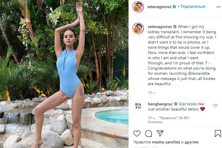Селена Гомес показала свой шрам после пересадки почки