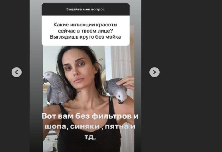 “Синяки и пятна”: Алана Мамаева показала себя без косметики и фотошопа