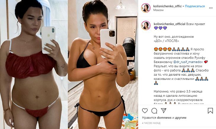 Звезда “Дома-2” Екатерина Колисниченко шокировала поклонников фигурой до липосакции
