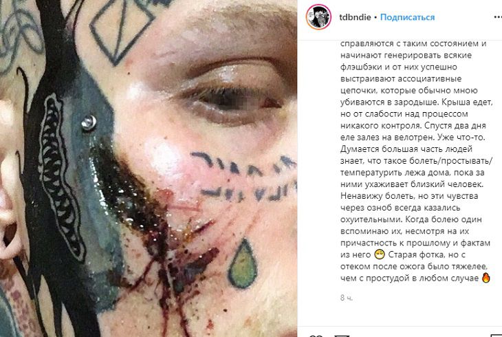 “Крыша едет”: Сын Елены Яковлевой рассказал о болезни