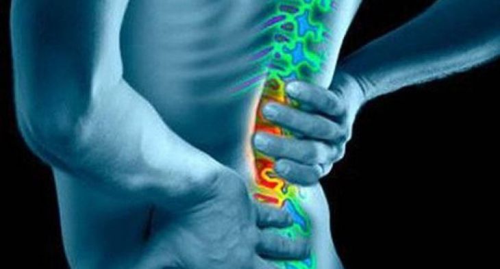 Можно ли вылечить радикулит? Можно ли вылечить радикулит?