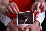 Умерший мужчина проявился на снимке УЗИ своего будущего внука