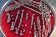 бактерии Aeromonas hydrophila