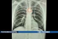 В Минске в ТЦ вор проглотил монеты, чтобы отделаться от милиции