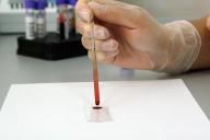 Названы основные пути заражения ВИЧ. Кто находится в зоне риска