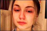 коронавирус