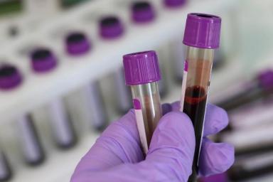 Названа самая «неудачная» группа крови при коронавирусе
