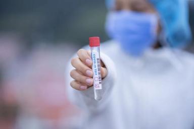 В Витебске начали делать платные тесты на коронавирус