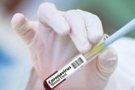НАН: Беларусь займется разработкой вакцины против COVID-19