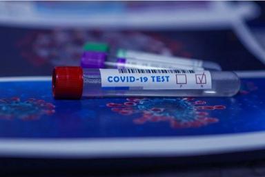 Минздрав рассказал, где в Минске делают экспресс-тесты на антитела к COVID-19