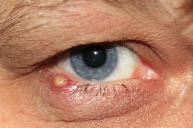 Эксперты рассказали, какие заболевания можно определить по глазам