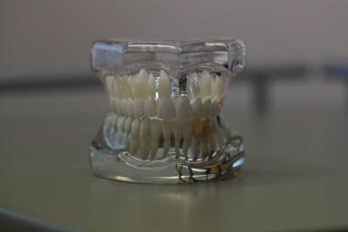 Ученые нашли связь между количеством выпавших зубов и продолжительностью жизни