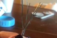 Это невозможно: Девушка показала устройство, которое помогло ей разбить тромб