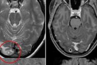 В это невозможно поверить: Врач был уверен, что у девушки рак, но у этой истории новый поворот 