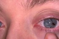 Таким родился: Парень похож на рептилию и рассказал, как видит мир