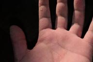 Не волшебство, а болезнь: Парень может создавать воду из ничего