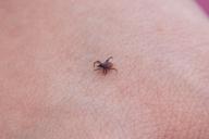 На Брестчине более 4 000 человек покусали клещи