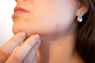 Косметологи перечислили главные ошибки женщин, которые ухудшают состояние кожи