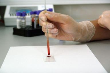 Этот способ поможет узнать свою группу крови без сдачи анализов
