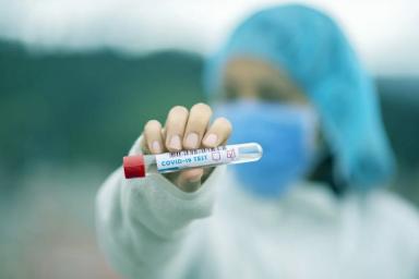 Сколько стоит тест на COVID-19 и на антитела? Минздрав Беларуси установил предельные тарифы
