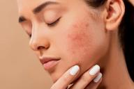 Какие 7 признаков выдают неухоженную женщину