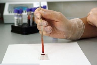 Как определить работу иммунитета по группе крови, выяснили медики