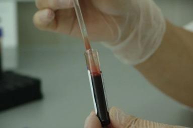 Как группа крови влияет на заболевания: ученые дали ответ